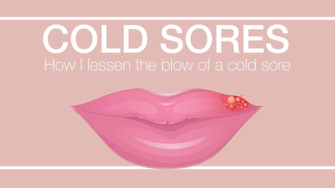 How To Avoid Cold Sores