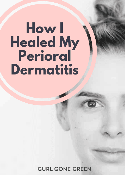 Perioral dermatitis natural