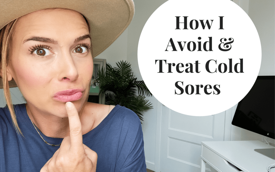 How I Avoid & Treat Cold Sores – All You Need To Know!