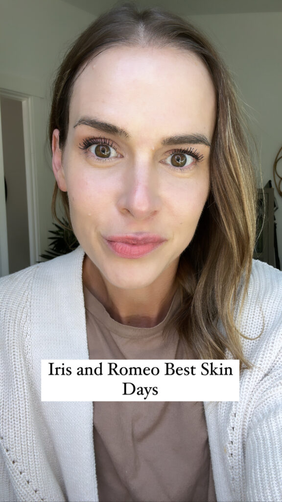 woman wearing Irs and Romeo Best Skin Days
