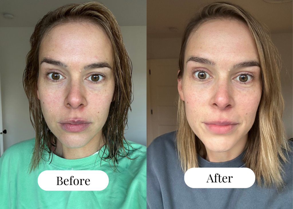 Woman showing face before facial cupping and comparing to after facial cupping