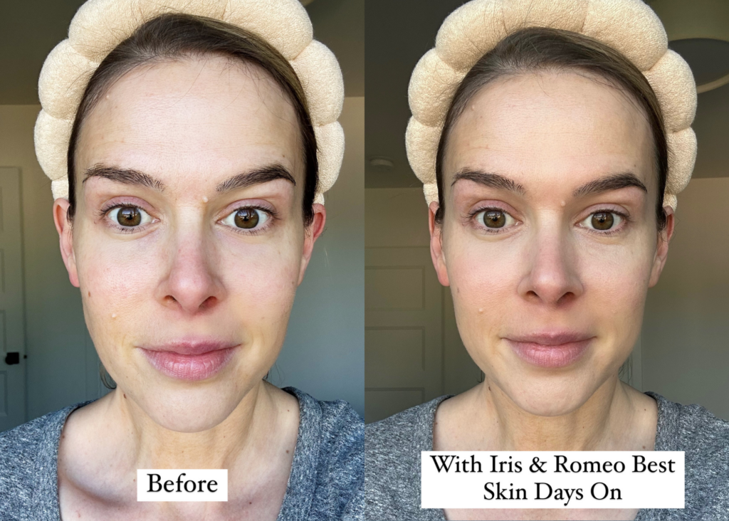 woman with no makeup on compared to woman wearing Iris and Rome's Best Skin Days